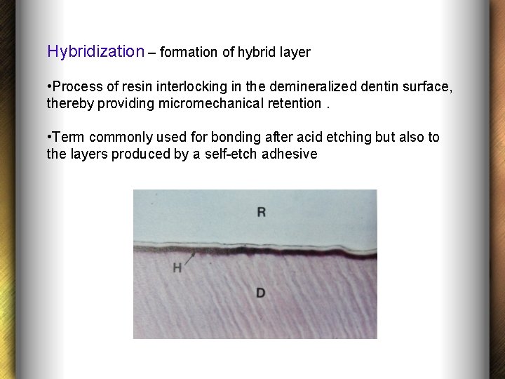 Hybridization – formation of hybrid layer • Process of resin interlocking in the demineralized