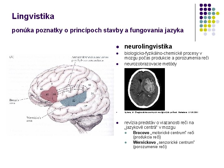 Lingvistika ponúka poznatky o princípoch stavby a fungovania jazyka l neurolingvistika l l biologicko-fyzikálno-chemické