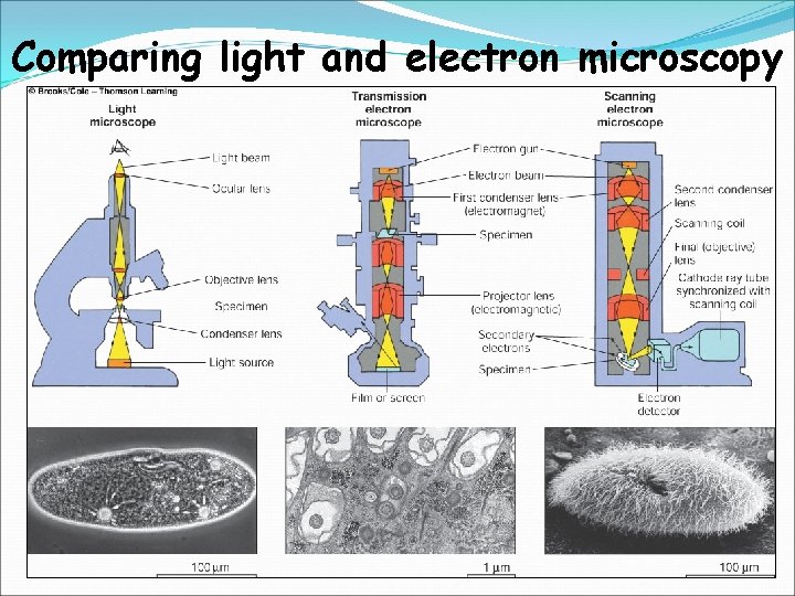 Comparing light and electron microscopy 