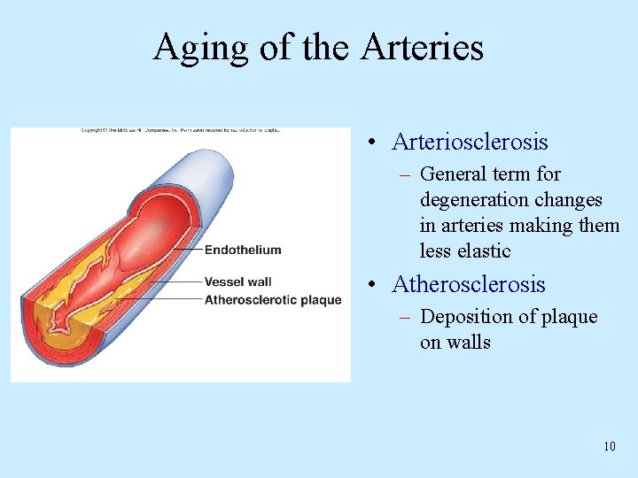 Aging of the Arteries • Arteriosclerosis – General term for degeneration changes in arteries