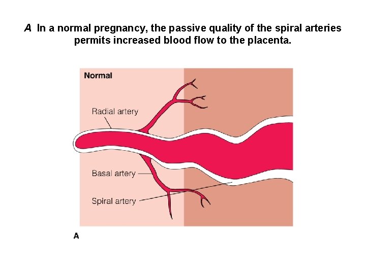 A In a normal pregnancy, the passive quality of the spiral arteries permits increased