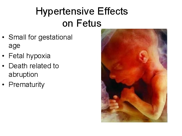 Hypertensive Effects on Fetus • Small for gestational age • Fetal hypoxia • Death