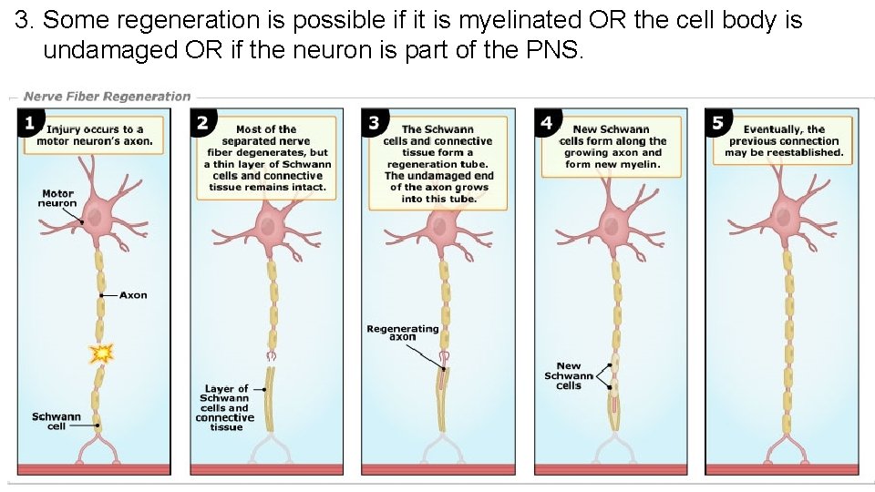 3. Some regeneration is possible if it is myelinated OR the cell body is