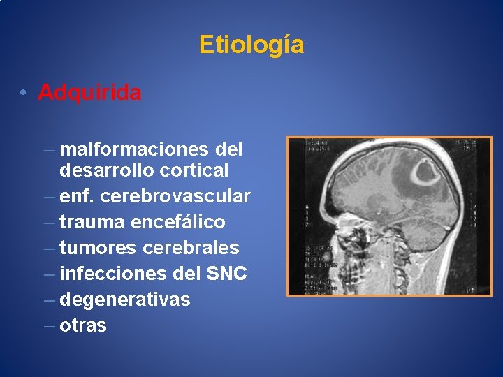 Etiología • Adquirida – malformaciones del desarrollo cortical – enf. cerebrovascular – trauma encefálico