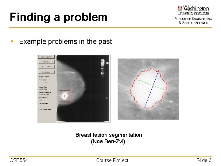 Finding a problem • Example problems in the past Breast lesion segmentation (Noa Ben-Zvi)
