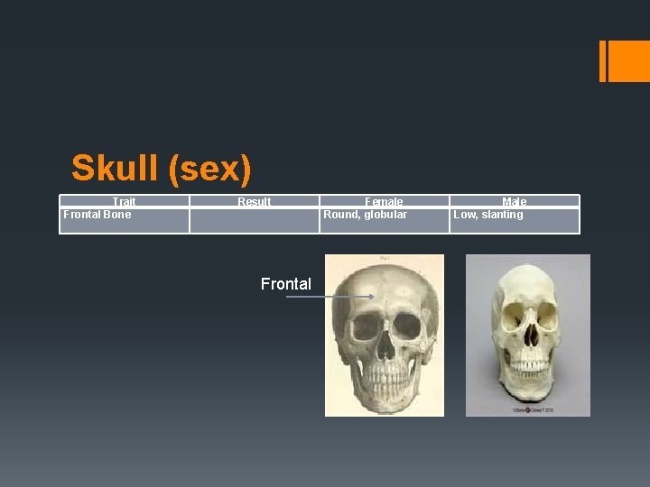 Skull (sex) Trait Frontal Bone Result Frontal Female Round, globular Male Low, slanting 