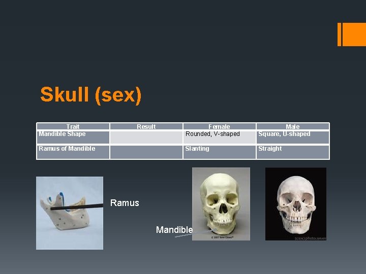 Skull (sex) Trait Mandible Shape Ramus of Mandible Result Female Rounded, V-shaped Male Square,