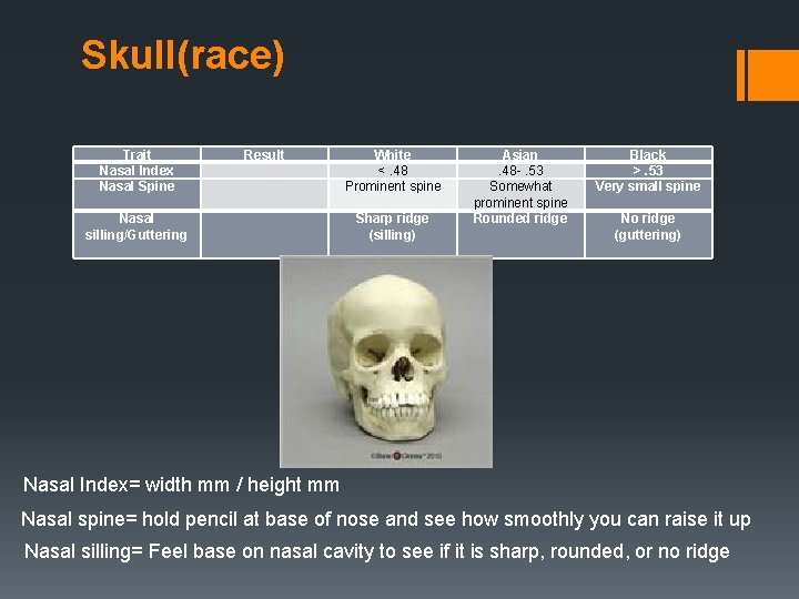 Skull(race) Trait Nasal Index Nasal Spine Result White <. 48 Prominent spine Nasal silling/Guttering