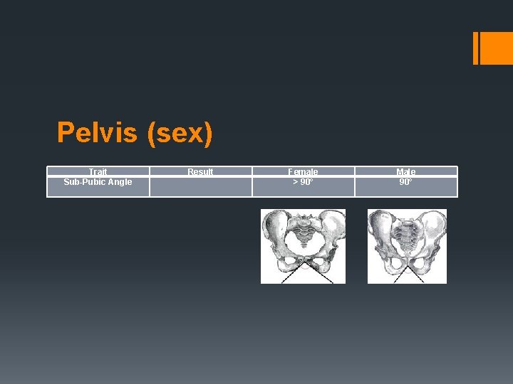 Pelvis (sex) Trait Sub-Pubic Angle Result Female > 90° Male 90° 