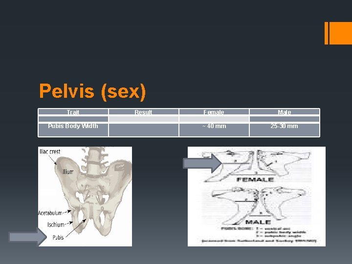 Pelvis (sex) Trait Pubis Body Width Result Female Male ~ 40 mm 25 -30