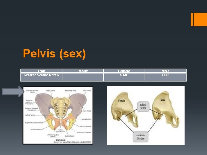 Pelvis (sex) Trait Greater Sciatic Notch Result Female > 68° Male < 68° 