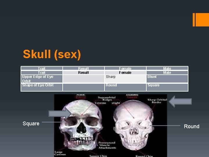 Skull (sex) Trait Upper Edge of Eye Orbit Shape of Eye Orbit Square Result