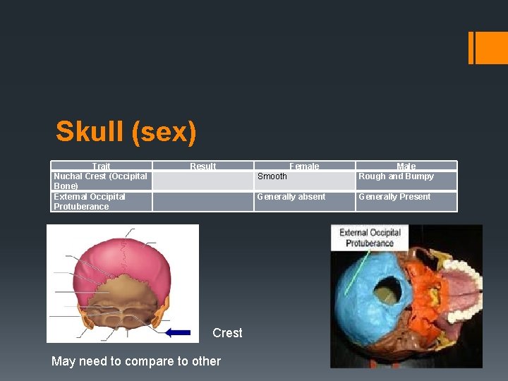 Skull (sex) Trait Nuchal Crest (Occipital Bone) External Occipital Protuberance Result Crest May need