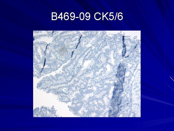 B 469 -09 CK 5/6 