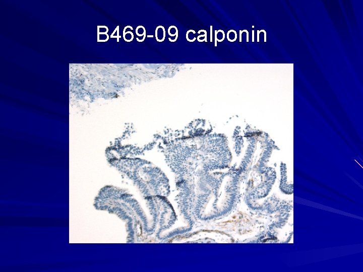 B 469 -09 calponin 
