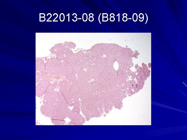 B 22013 -08 (B 818 -09) 