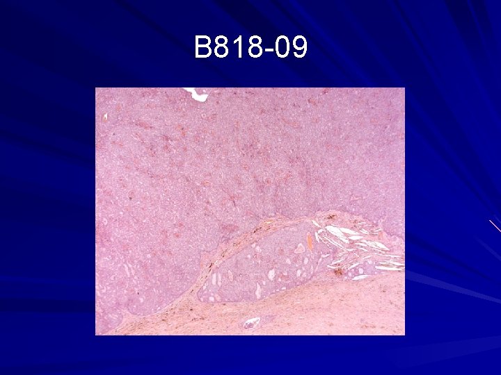 B 818 -09 
