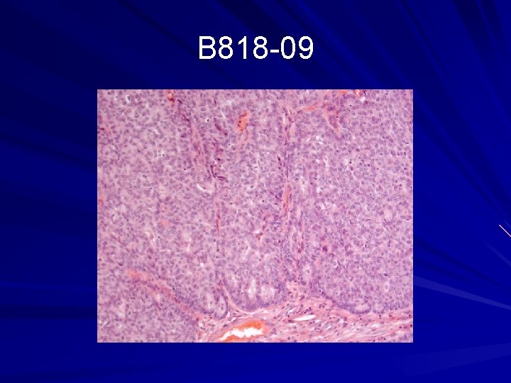 B 818 -09 