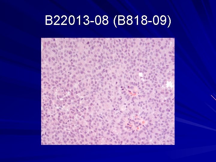 B 22013 -08 (B 818 -09) 