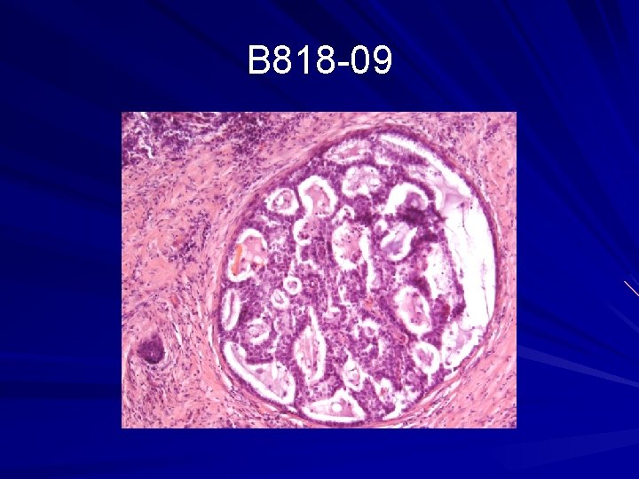 B 818 -09 