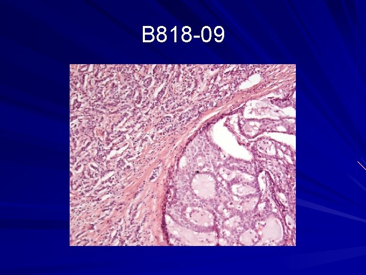 B 818 -09 