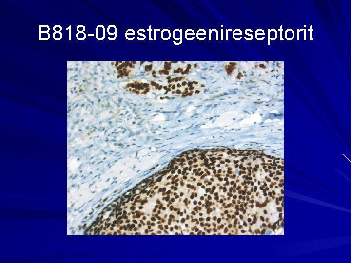B 818 -09 estrogeenireseptorit 