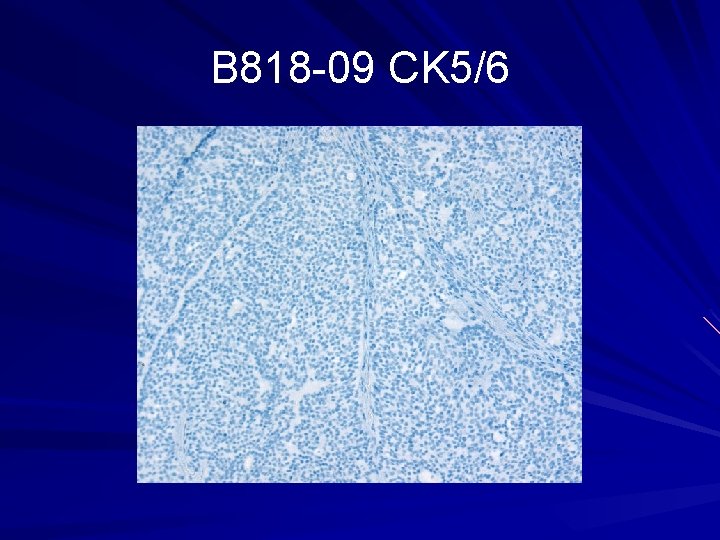 B 818 -09 CK 5/6 