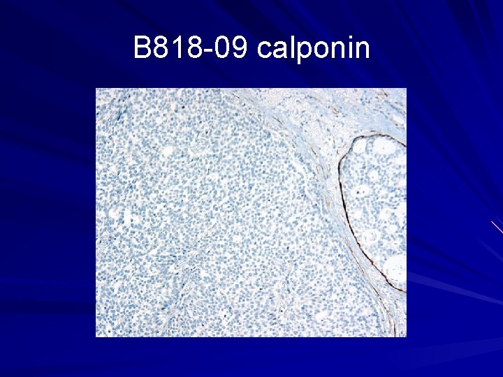 B 818 -09 calponin 