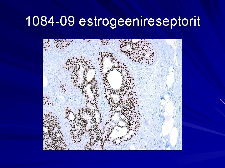 1084 -09 estrogeenireseptorit 