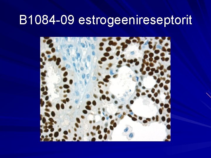 B 1084 -09 estrogeenireseptorit 
