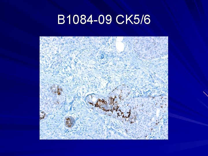 B 1084 -09 CK 5/6 