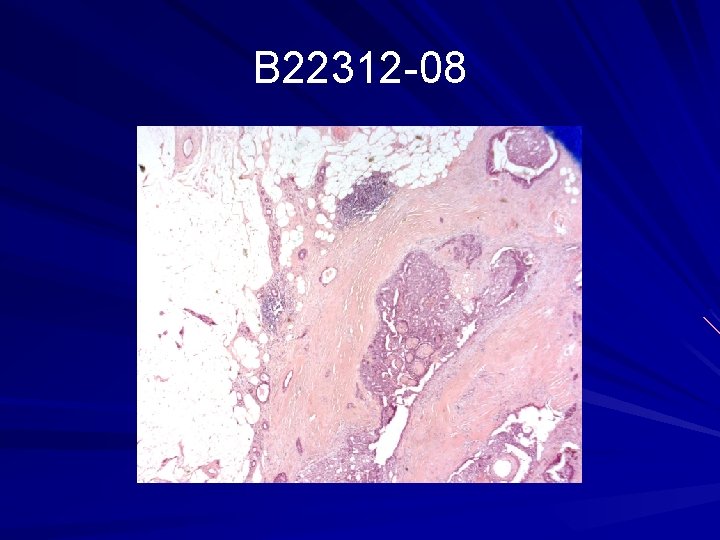 B 22312 -08 