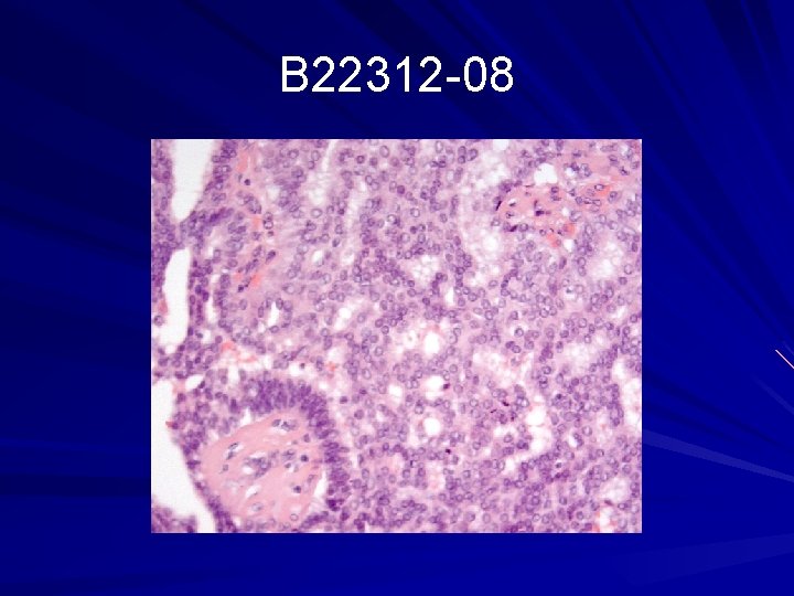 B 22312 -08 
