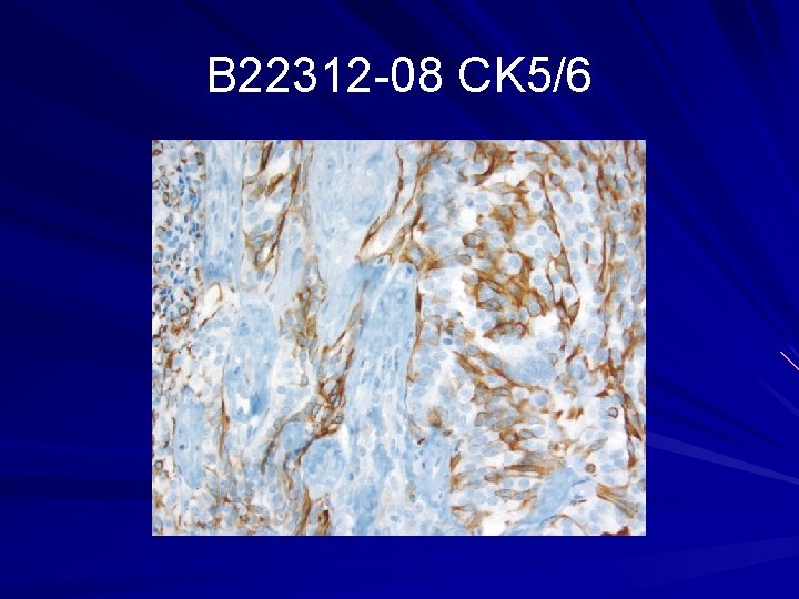 B 22312 -08 CK 5/6 