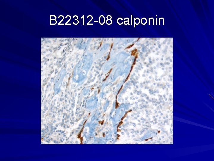 B 22312 -08 calponin 