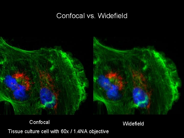 Confocal vs. Widefield Confocal Tissue culture cell with 60 x / 1. 4 NA