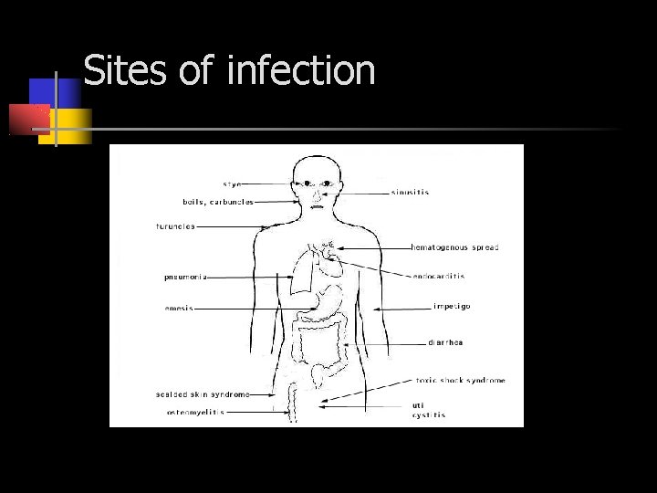 Sites of infection 