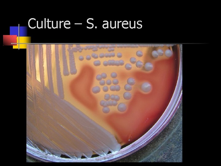 Culture – S. aureus 