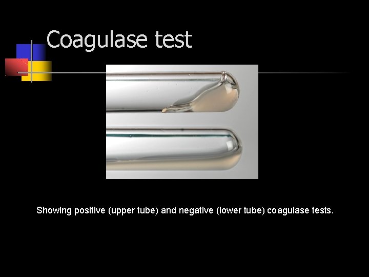 Coagulase test Showing positive (upper tube) and negative (lower tube) coagulase tests. 