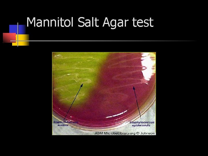 Mannitol Salt Agar test 