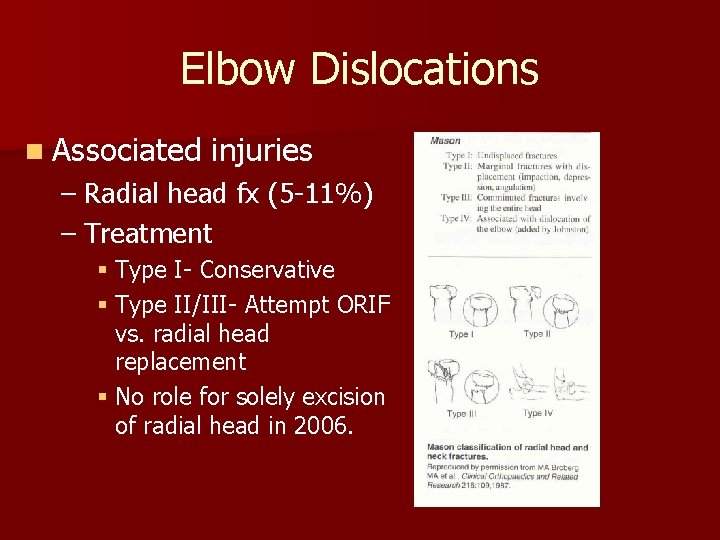 Elbow Dislocations n Associated injuries – Radial head fx (5 -11%) – Treatment §