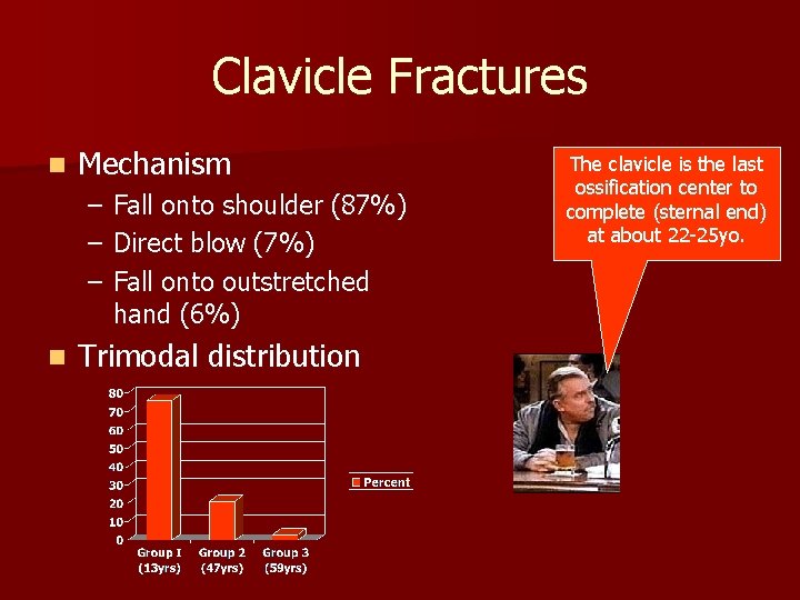 Clavicle Fractures n Mechanism – – – n Fall onto shoulder (87%) Direct blow