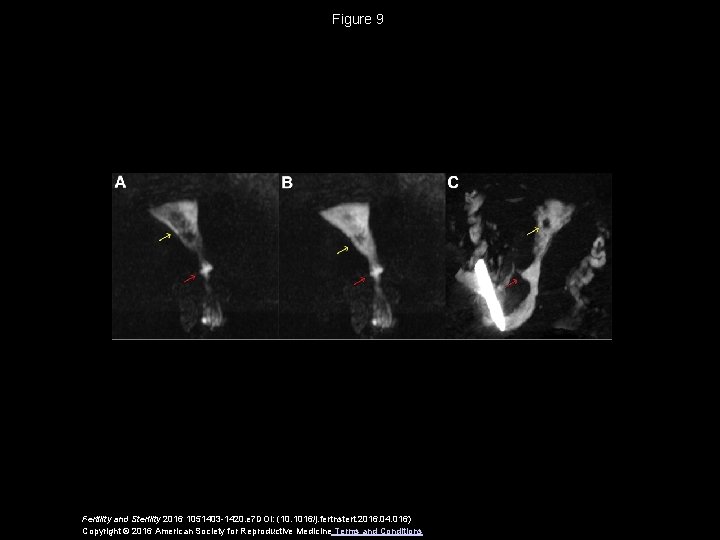 Figure 9 Fertility and Sterility 2016 1051403 -1420. e 7 DOI: (10. 1016/j. fertnstert.