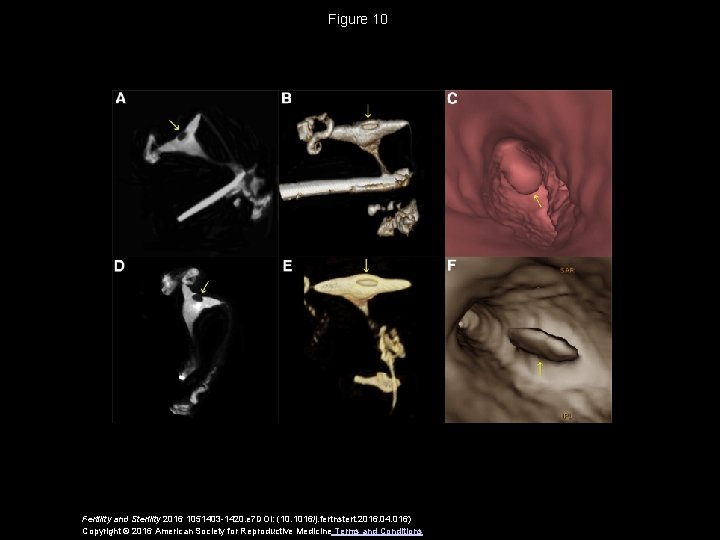 Figure 10 Fertility and Sterility 2016 1051403 -1420. e 7 DOI: (10. 1016/j. fertnstert.