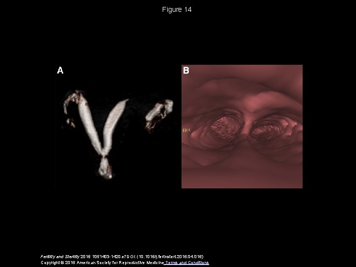 Figure 14 Fertility and Sterility 2016 1051403 -1420. e 7 DOI: (10. 1016/j. fertnstert.