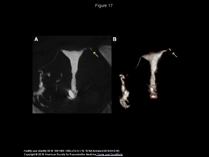 Figure 17 Fertility and Sterility 2016 1051403 -1420. e 7 DOI: (10. 1016/j. fertnstert.