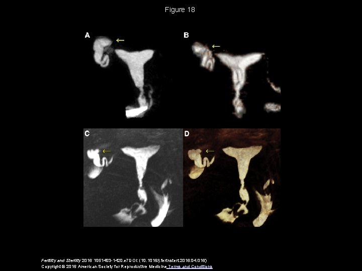 Figure 18 Fertility and Sterility 2016 1051403 -1420. e 7 DOI: (10. 1016/j. fertnstert.