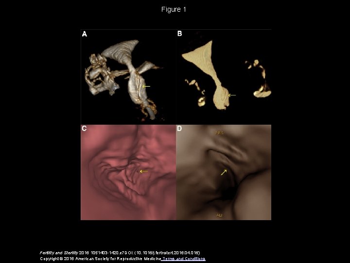 Figure 1 Fertility and Sterility 2016 1051403 -1420. e 7 DOI: (10. 1016/j. fertnstert.