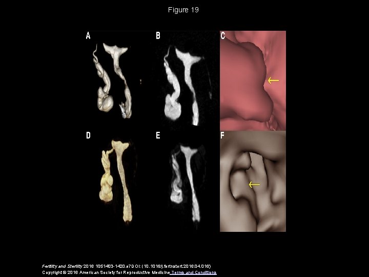 Figure 19 Fertility and Sterility 2016 1051403 -1420. e 7 DOI: (10. 1016/j. fertnstert.