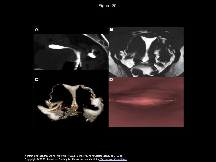 Figure 20 Fertility and Sterility 2016 1051403 -1420. e 7 DOI: (10. 1016/j. fertnstert.